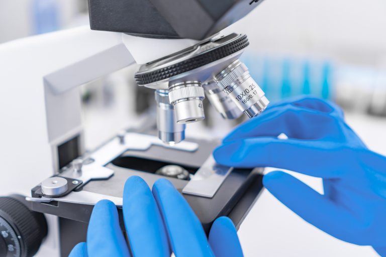 Scientist analyzing microscope slide at laboratory. Young woman technician is examining a histological sample, a biopsy in the laboratory of cancer research
