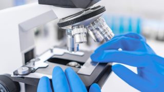 Scientist analyzing microscope slide at laboratory. Young woman technician is examining a histological sample, a biopsy in the laboratory of cancer research