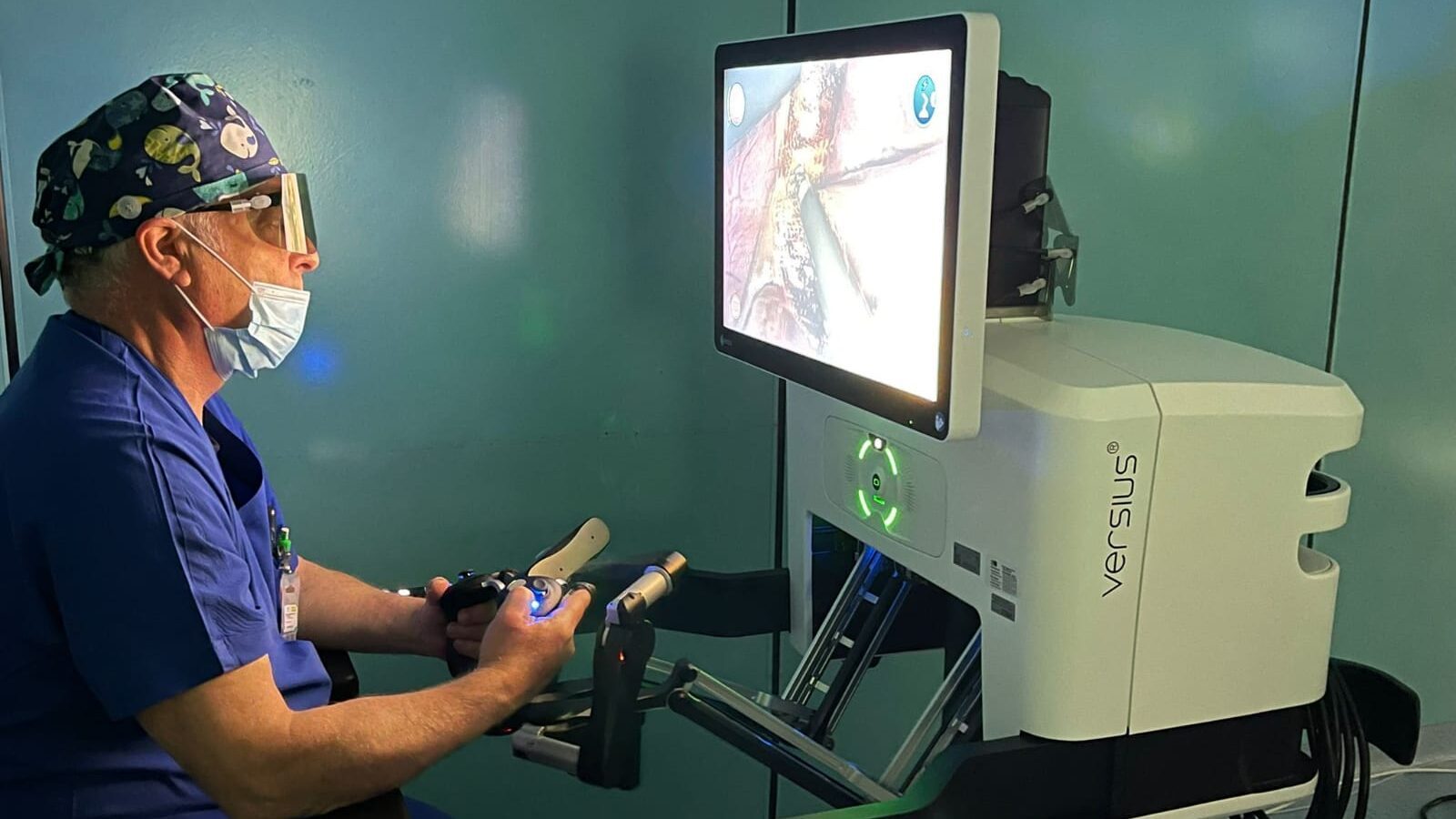 Robot Versius Lamezia 1